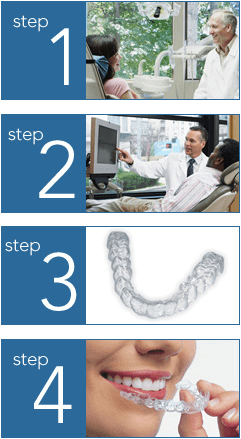 The steps taken to get Invisalign